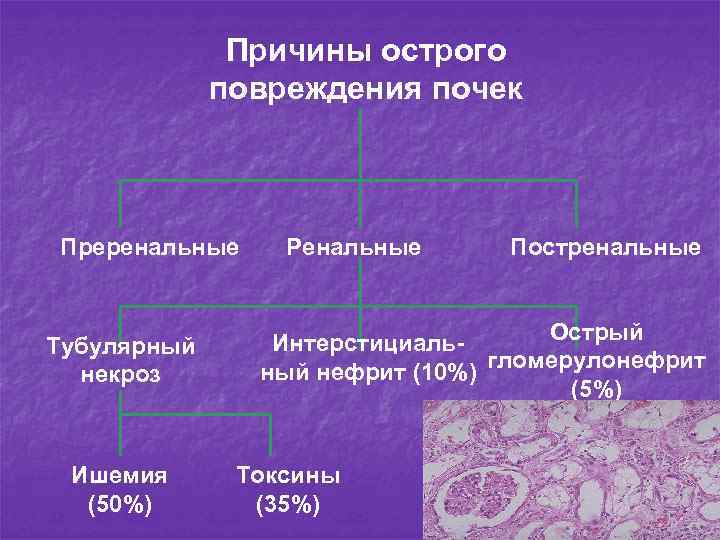 Причины острого повреждения почек Преренальные Тубулярный некроз Ишемия (50%) Ренальные Постренальные Острый Интерстициальный нефрит