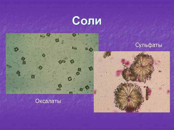 Соли Сульфаты Оксалаты 