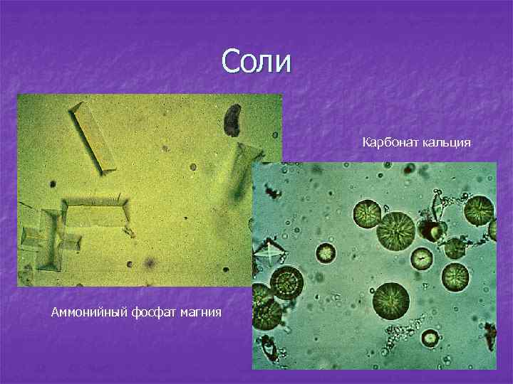 Соли Карбонат кальция Аммонийный фосфат магния 