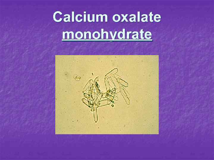 Calcium oxalate monohydrate 