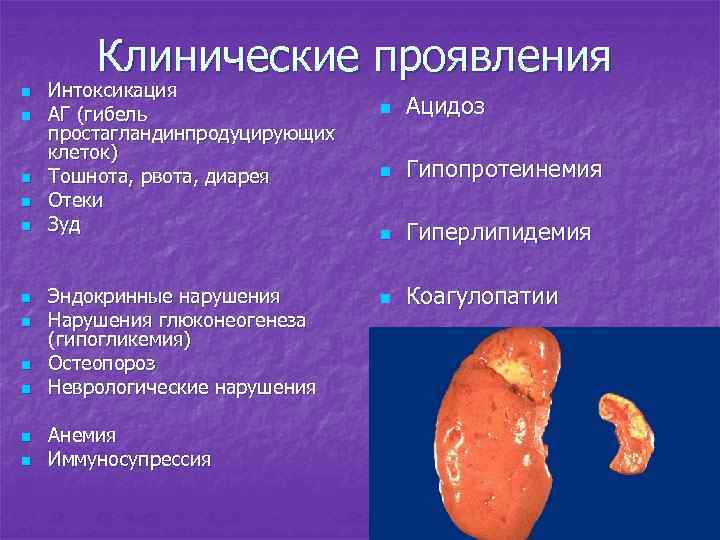 Клинические проявления n n n Интоксикация АГ (гибель простагландинпродуцирующих клеток) Тошнота, рвота, диарея Отеки