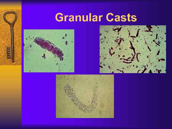 Granular Casts 