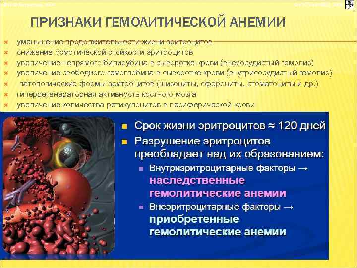 © П. Ф. Литвицкий, 2004 © ГЭОТАР-МЕД, 2004 ПРИЗНАКИ ГЕМОЛИТИЧЕСКОЙ АНЕМИИ уменьшение продолжительности жизни