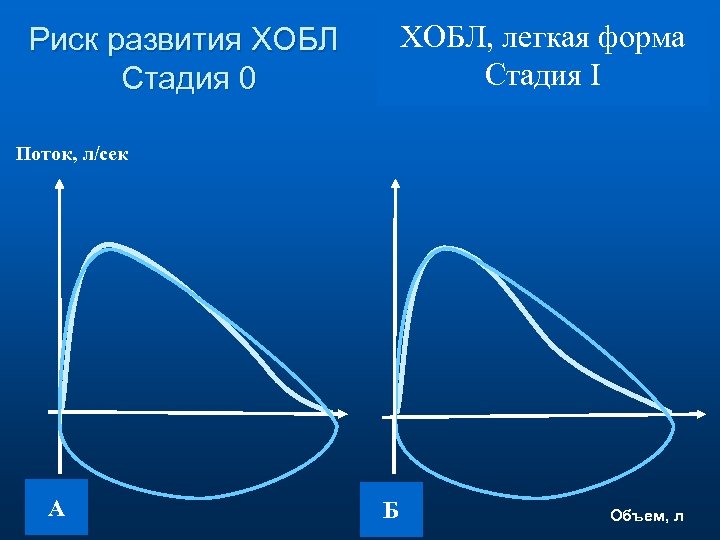 ХОБЛ, легкая форма Стадия I Риск развития ХОБЛ Стадия 0 Поток, л/сек А Б