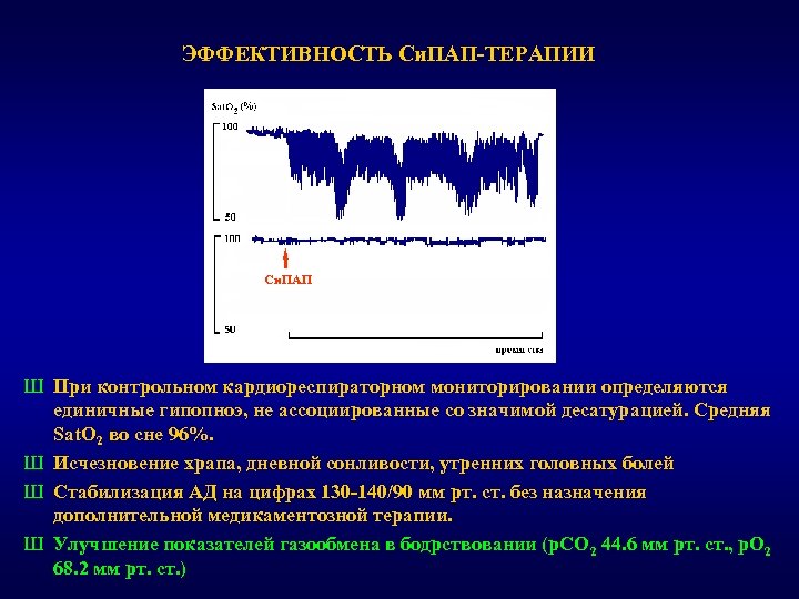 ЭФФЕКТИВНОСТЬ Си. ПАП-ТЕРАПИИ Си. ПАП Ш При контрольном кардиореспираторном мониторировании определяются единичные гипопноэ, не