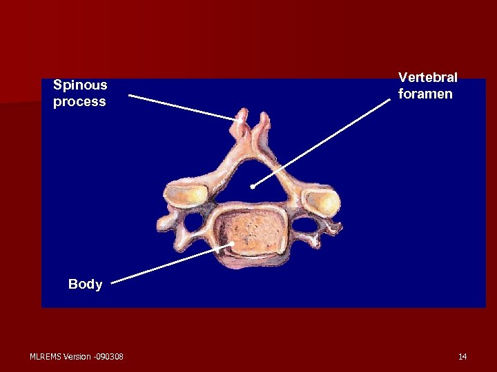 Spinous process Vertebral foramen Body MLREMS Version -090308 14 