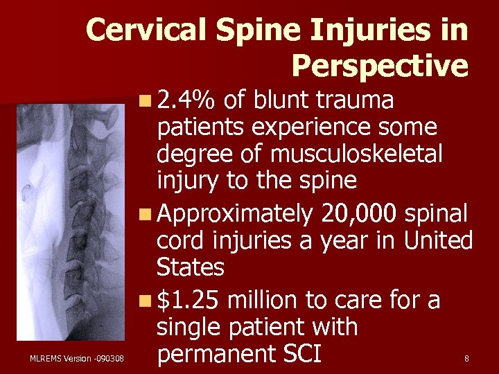 Cervical Spine Injuries in Perspective n 2. 4% MLREMS Version -090308 of blunt trauma