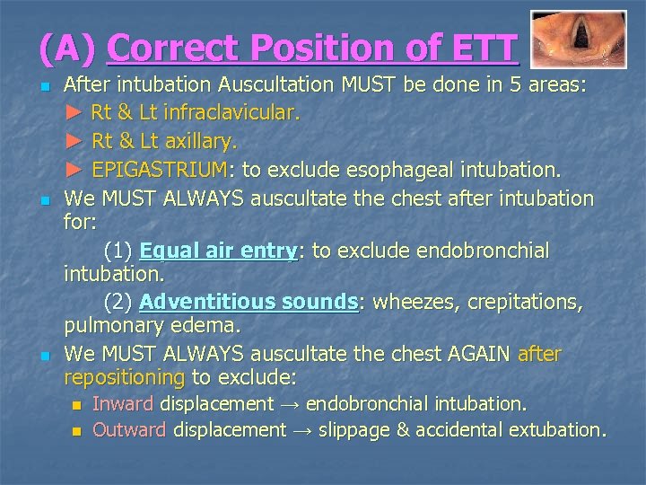 (A) Correct Position of ETT n n n After intubation Auscultation MUST be done