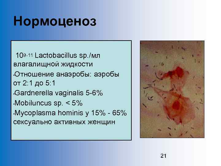 Нормоценоз 109 -11 Lactobacillus sp. /мл влагалищной жидкости • Отношение анаэробы: аэробы от 2: