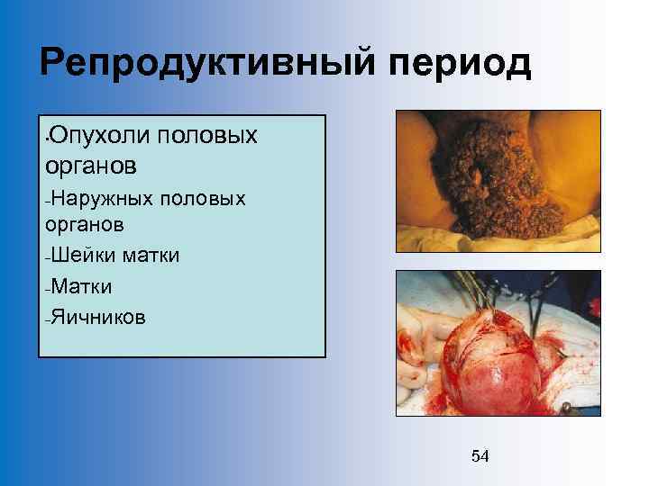 Репродуктивный период Опухоли половых органов • Наружных половых органов –Шейки матки –Матки –Яичников –