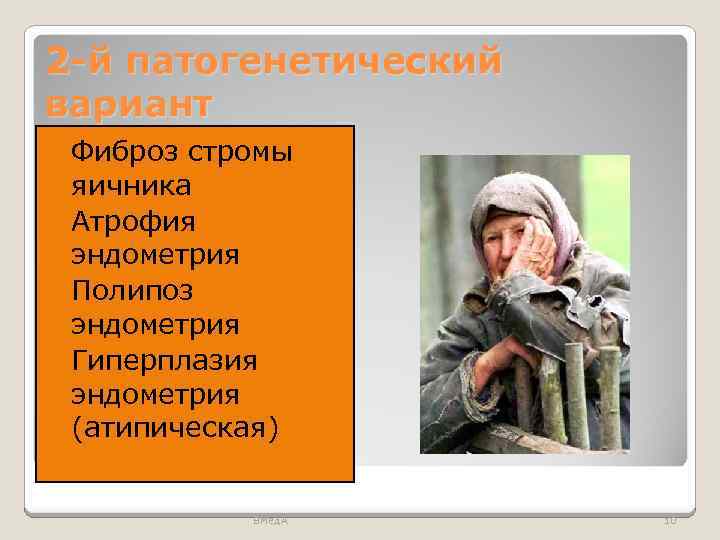 2 -й патогенетический вариант Фиброз стромы яичника Атрофия эндометрия Полипоз эндометрия Гиперплазия эндометрия (атипическая)