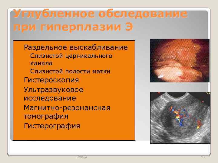 Углубленное обследование при гиперплазии Э Раздельное выскабливание ◦ Слизистой цервикального канала ◦ Слизистой полости