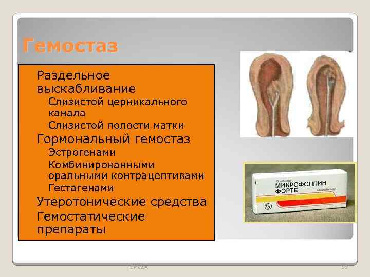 Гемостаз Раздельное выскабливание ◦ Слизистой цервикального канала ◦ Слизистой полости матки Гормональный гемостаз ◦