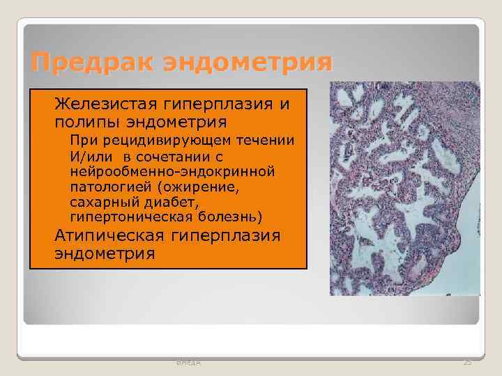 Предрак эндометрия Железистая гиперплазия и полипы эндометрия ◦ При рецидивирующем течении ◦ И/или в