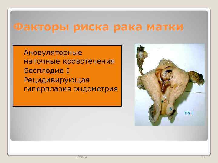 Факторы риска рака матки Ановуляторные маточные кровотечения Бесплодие I Рецидивирующая гиперплазия эндометрия ВМед. А