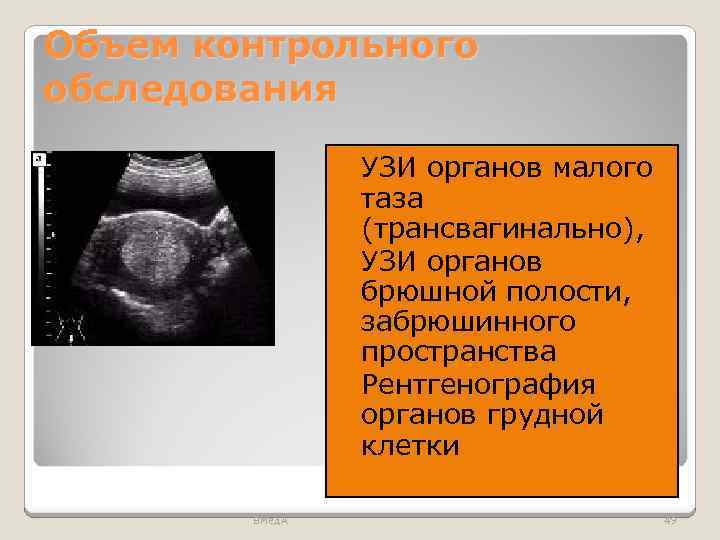 Объем контрольного обследования УЗИ органов малого таза (трансвагинально), УЗИ органов брюшной полости, забрюшинного пространства