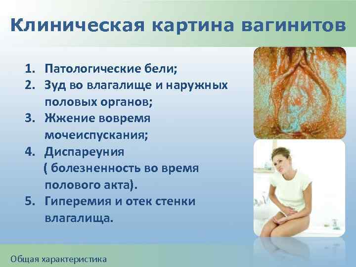 Клиническая картина вагинитов 1. Патологические бели; 2. Зуд во влагалище и наружных половых органов;
