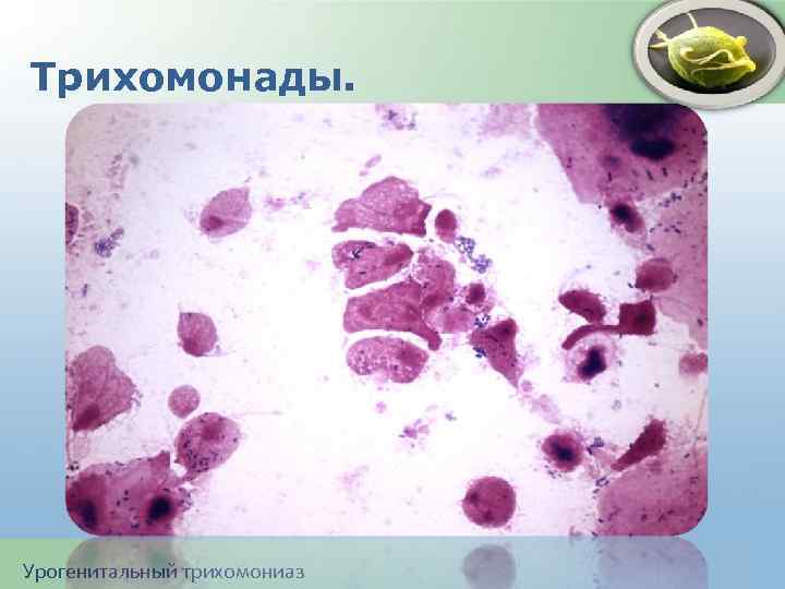 Трихомонады. Урогенитальный трихомониаз 