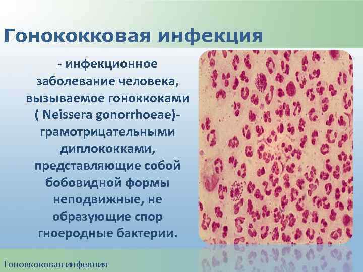Гонококковая инфекция - инфекционное заболевание человека, вызываемое гоноккоками ( Neissera gonorrhoeae)грамотрицательными диплококками, представляющие собой