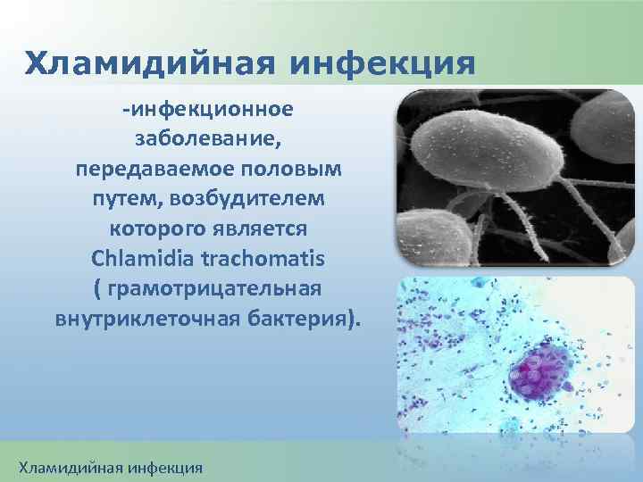 Хламидийная инфекция -инфекционное заболевание, передаваемое половым путем, возбудителем которого является Chlamidia trachomatis ( грамотрицательная
