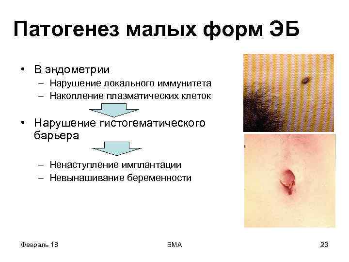 Патогенез малых форм ЭБ • В эндометрии – Нарушение локального иммунитета – Накопление плазматических