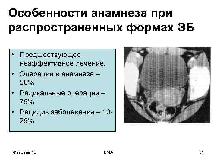 Особенности анамнеза при распространенных формах ЭБ • Предшествующее неэффективное лечение. • Операции в анамнезе