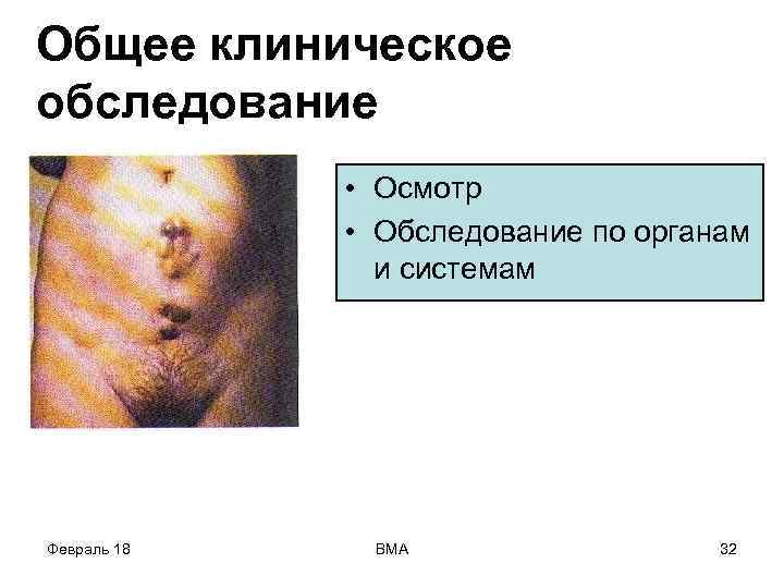 Общее клиническое обследование • Осмотр • Обследование по органам и системам Февраль 18 ВМА