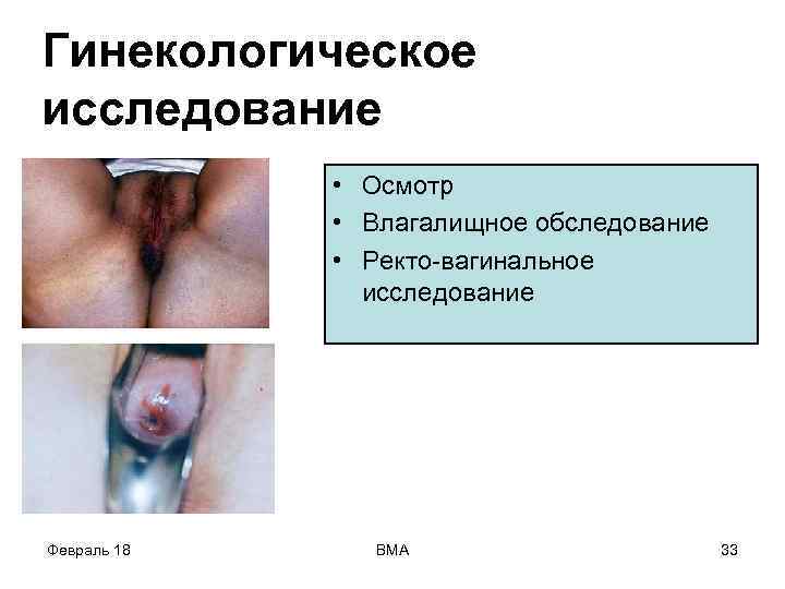 Гинекологическое исследование • Осмотр • Влагалищное обследование • Ректо-вагинальное исследование Февраль 18 ВМА 33