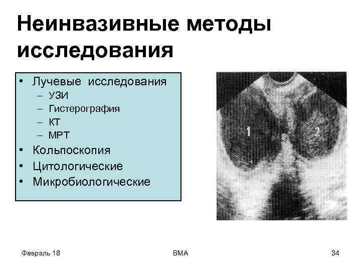 Неинвазивные методы исследования • Лучевые исследования – – УЗИ Гистерография КТ МРТ • Кольпоскопия