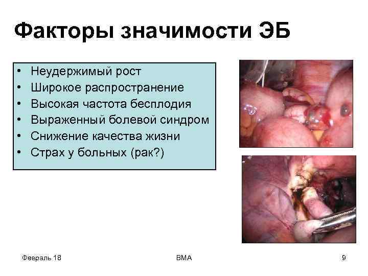 Факторы значимости ЭБ • • • Неудержимый рост Широкое распространение Высокая частота бесплодия Выраженный