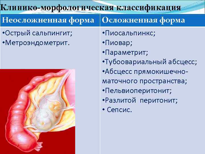 Клинико-морфологическая классификация Неосложненная форма Осложненная форма • Острый сальпингит; • Метроэндометрит. • Пиосальпинкс; •