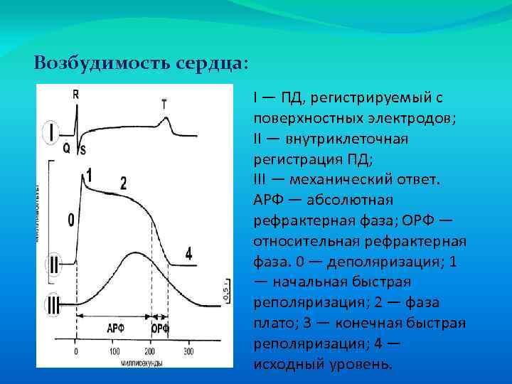 Возбудимость сердца: I — ПД, регистрируемый с поверхностных электродов; II — внутриклеточная регистрация ПД;