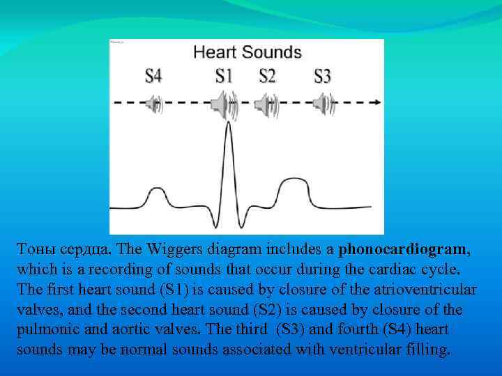 Тоны сердца. The Wiggers diagram includes a phonocardiogram, which is a recording of sounds