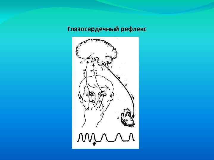 Глазосердечный рефлекс схема