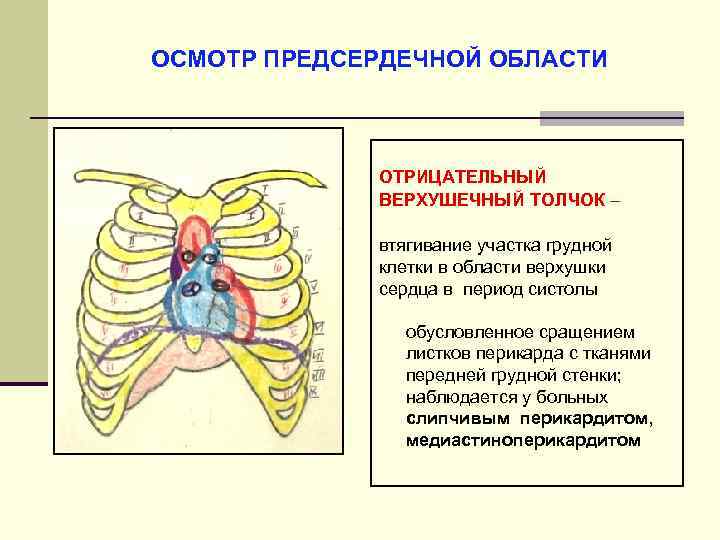 ОСМОТР ПРЕДСЕРДЕЧНОЙ ОБЛАСТИ ОТРИЦАТЕЛЬНЫЙ ВЕРХУШЕЧНЫЙ ТОЛЧОК – втягивание участка грудной клетки в области верхушки