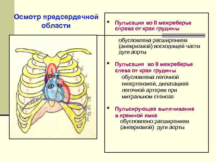 Второе межреберье справа. Пульсация во втором межреберье справа. Пульсация в яремной ямке. Пульсация аорты в яремной ямке.