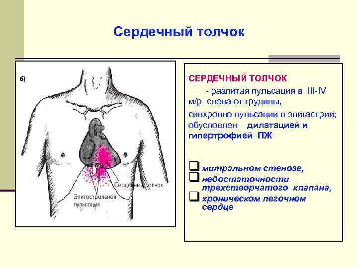 Сердечный толчок определяется