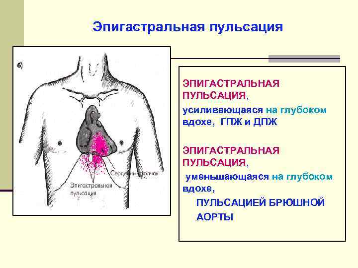 Пульсирующая брюшная аорта