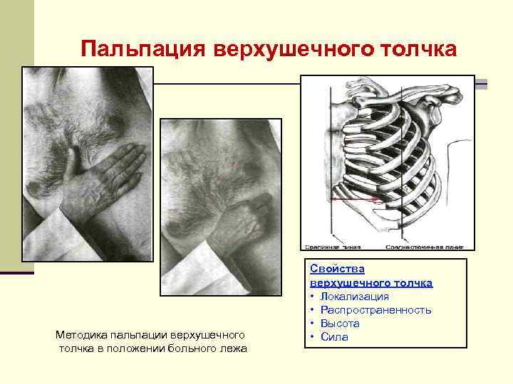 Пальпация верхушечного толчка Методика пальпации верхушечного толчка в положении больного лежа Свойства верхушечного толчка