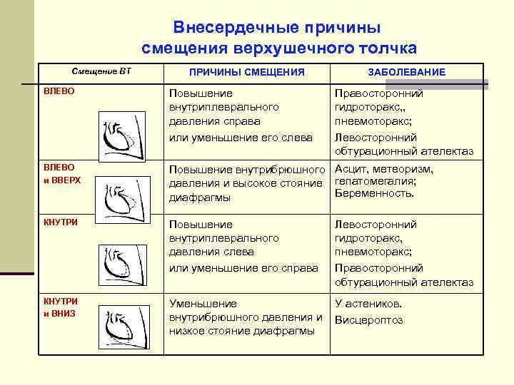 Внесердечные причины смещения верхушечного толчка Смещение ВТ ПРИЧИНЫ СМЕЩЕНИЯ ЗАБОЛЕВАНИЕ ВЛЕВО Повышение внутриплеврального давления