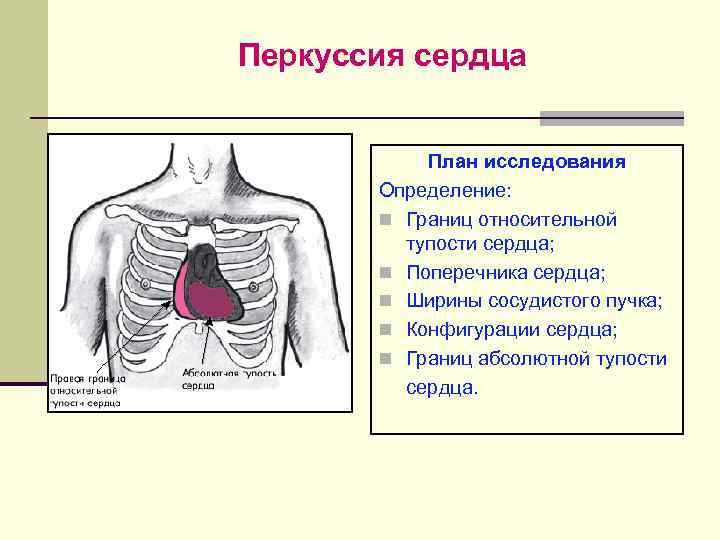 Перкуссия сердца в картинках