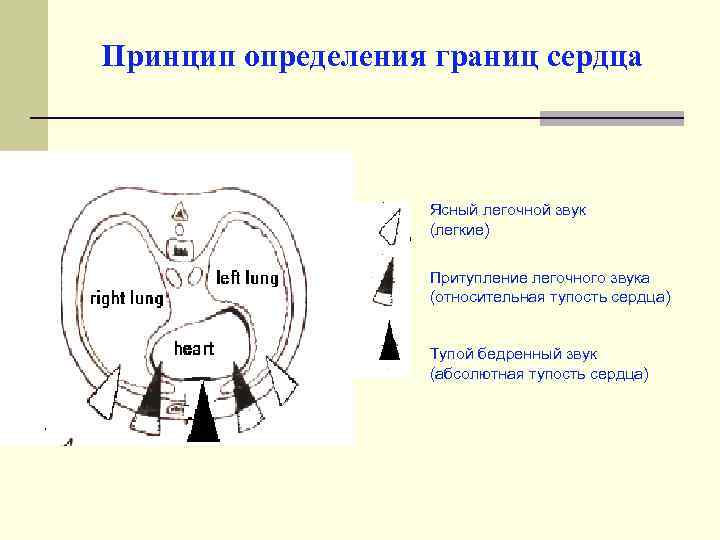 Принцип определения границ сердца Ясный легочной звук (легкие) Притупление легочного звука (относительная тупость сердца)