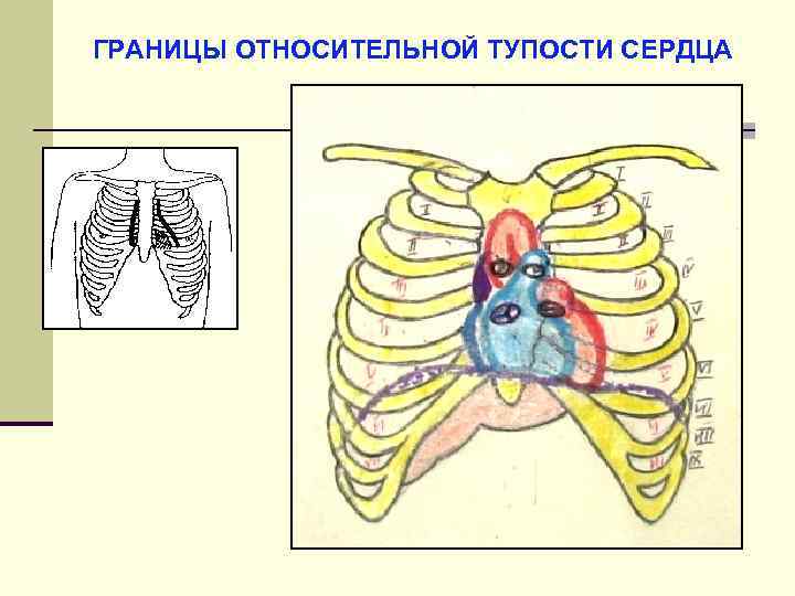 Верхняя граница сердца в норме. Границы относительной тупости сердца. Границы относительноцтупости сергдца. Границы сердца при патологии. Относительная сердечная тупость границы.