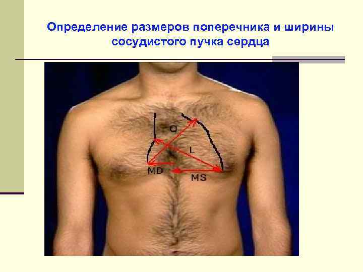 Определение размеров поперечника и ширины сосудистого пучка сердца 