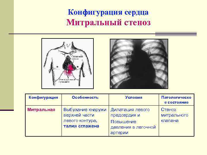 Конфигурация сердца