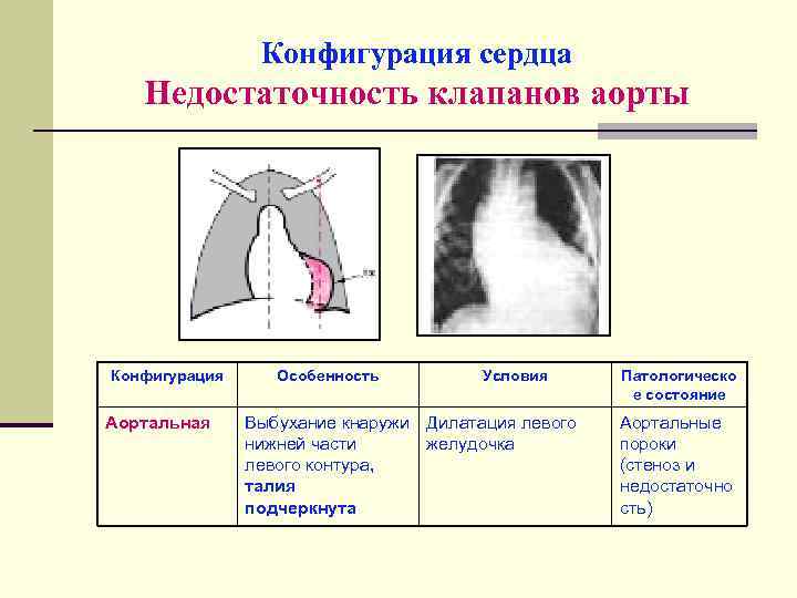 Нормальная конфигурация сердца рисунок