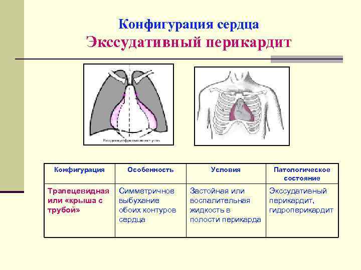 Нормальная конфигурация сердца рисунок