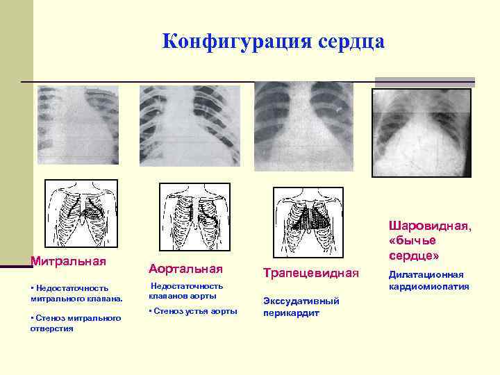 Нормальная конфигурация сердца рисунок