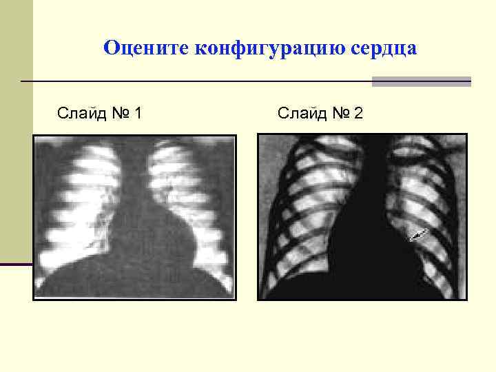 Оцените конфигурацию сердца Слайд № 1 Слайд № 2 