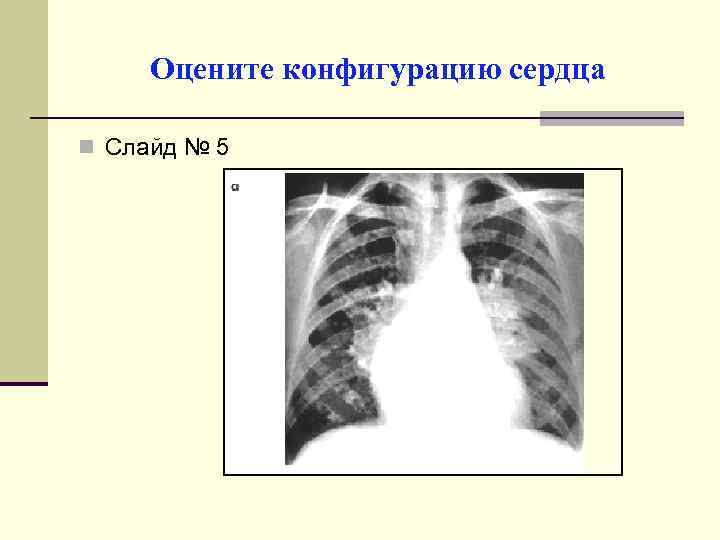 Оцените конфигурацию сердца n Слайд № 5 